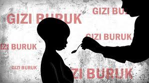 Populasi Gizi Buruk di Riau Terus Meningkat!
